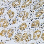 Immunohistochemistry - Anti-MASPIN Antibody (A89880) - Antibodies.com