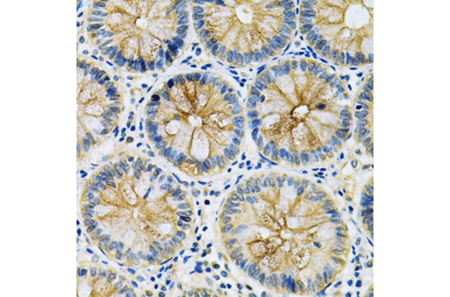 Immunohistochemistry - Anti-MASPIN Antibody (A89880) - Antibodies.com