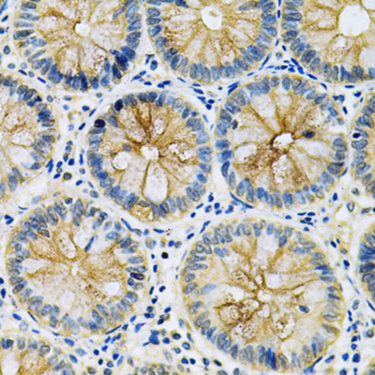 Immunohistochemistry - Anti-MASPIN Antibody (A89880) - Antibodies.com