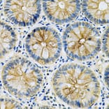 Immunohistochemistry - Anti-MASPIN Antibody (A89880) - Antibodies.com