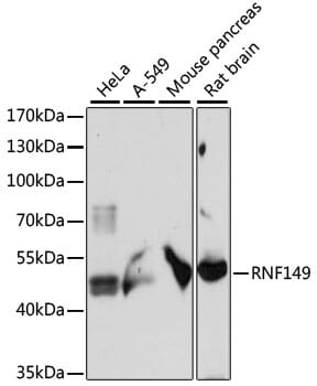 Western blot analysis of extracts of various cell lines, using Anti-RNF149 Antibody (A15627) at 1:1,000 dilution.
Secondary antibody: Goat Anti-Rabbit IgG (H+L) (HRP) (AS014) at 1:10,000 dilution.
Lysates / proteins: 25µg per lane.
Blocking buffer: 3% non-fat dry milk in TBST.
Detection: ECL Basic Kit (RM00020).
Exposure time: 30s.