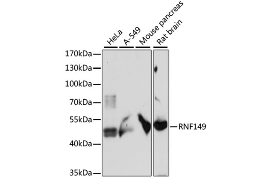 Western Blot - Anti-RNF149 Antibody (A89882) - Antibodies.com