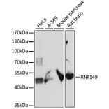 Western Blot - Anti-RNF149 Antibody (A89882) - Antibodies.com