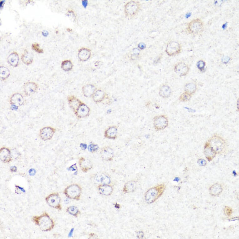 Immunohistochemistry - Anti-RNF149 Antibody (A89882) - Antibodies.com