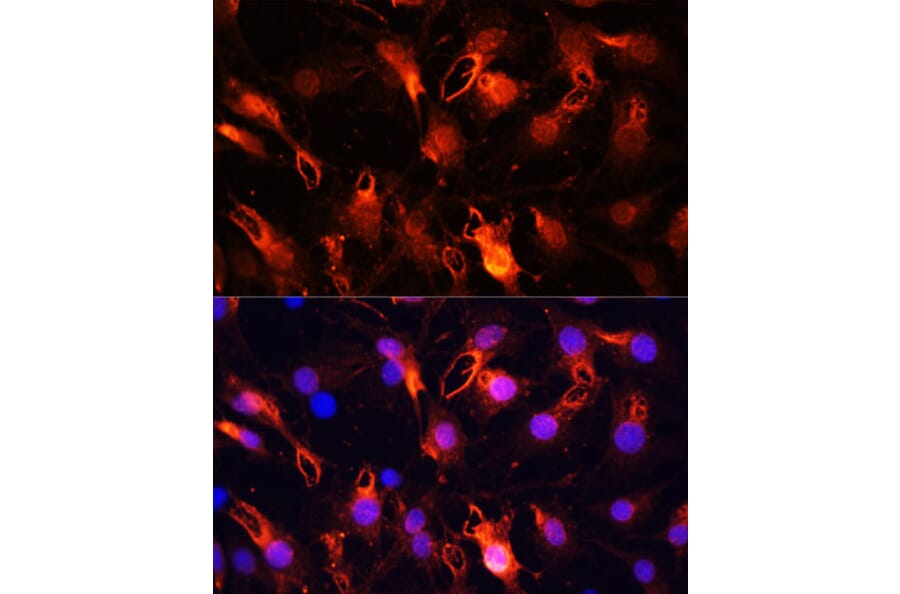 Immunofluorescence - Anti-RNF149 Antibody (A89882) - Antibodies.com