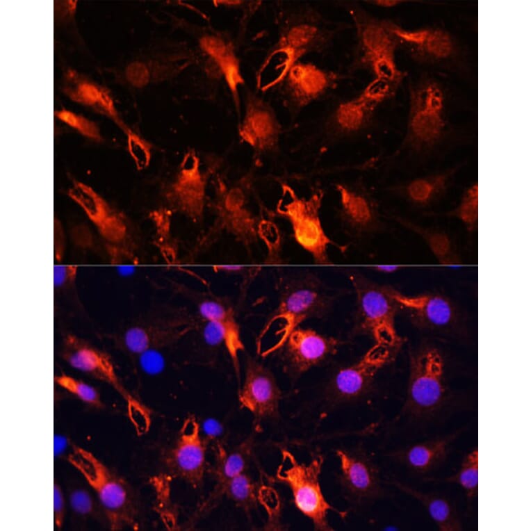 Immunofluorescence - Anti-RNF149 Antibody (A89882) - Antibodies.com