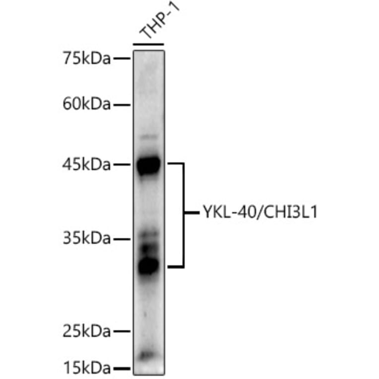 Western Blot - Anti-YKL-40/CHI3L1 Antibody (A89883) - Antibodies.com