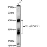 Western Blot - Anti-YKL-40/CHI3L1 Antibody (A89883) - Antibodies.com