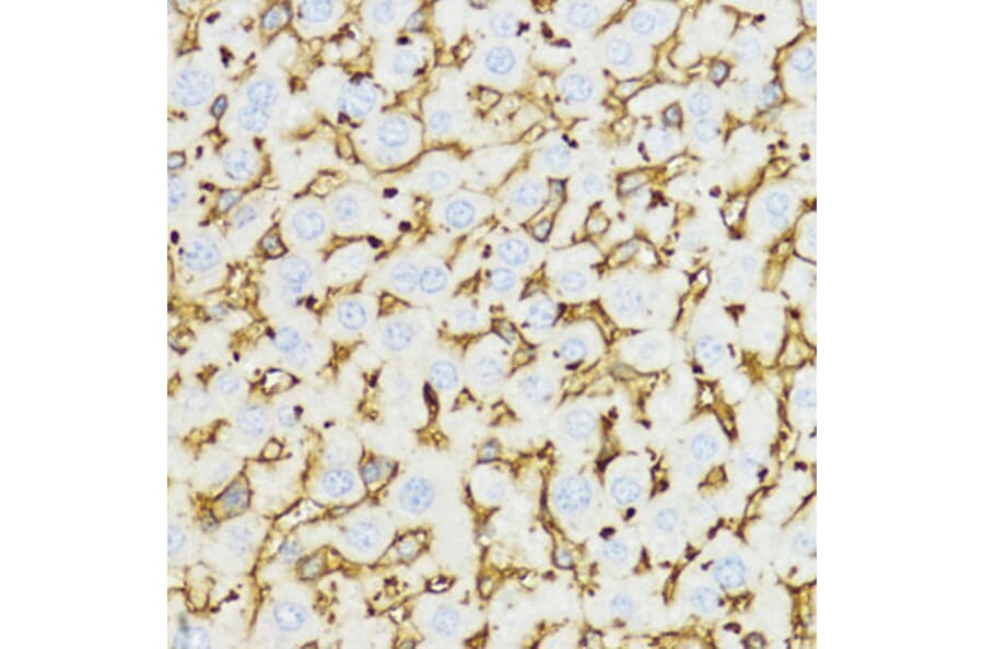 Immunohistochemistry - Anti-YKL-40/CHI3L1 Antibody (A89883) - Antibodies.com