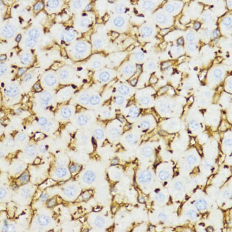 Immunohistochemistry - Anti-YKL-40/CHI3L1 Antibody (A89883) - Antibodies.com