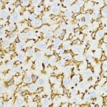 Immunohistochemistry - Anti-YKL-40/CHI3L1 Antibody (A89883) - Antibodies.com