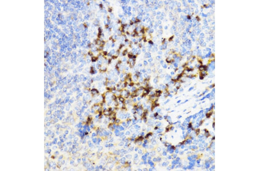 Immunohistochemistry - Anti-YKL-40/CHI3L1 Antibody (A89883) - Antibodies.com