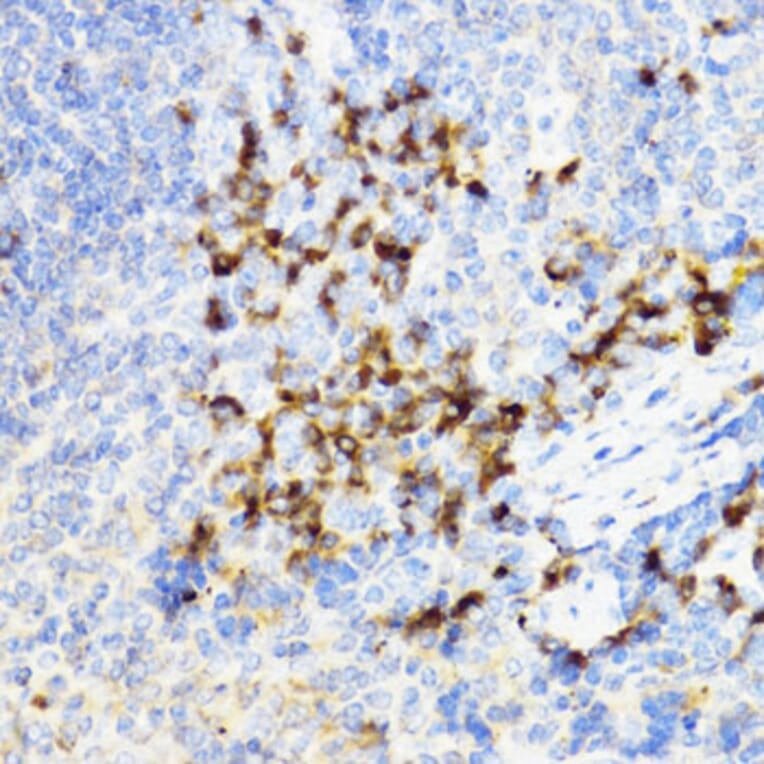 Immunohistochemistry - Anti-YKL-40/CHI3L1 Antibody (A89883) - Antibodies.com