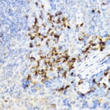 Immunohistochemistry - Anti-YKL-40/CHI3L1 Antibody (A89883) - Antibodies.com