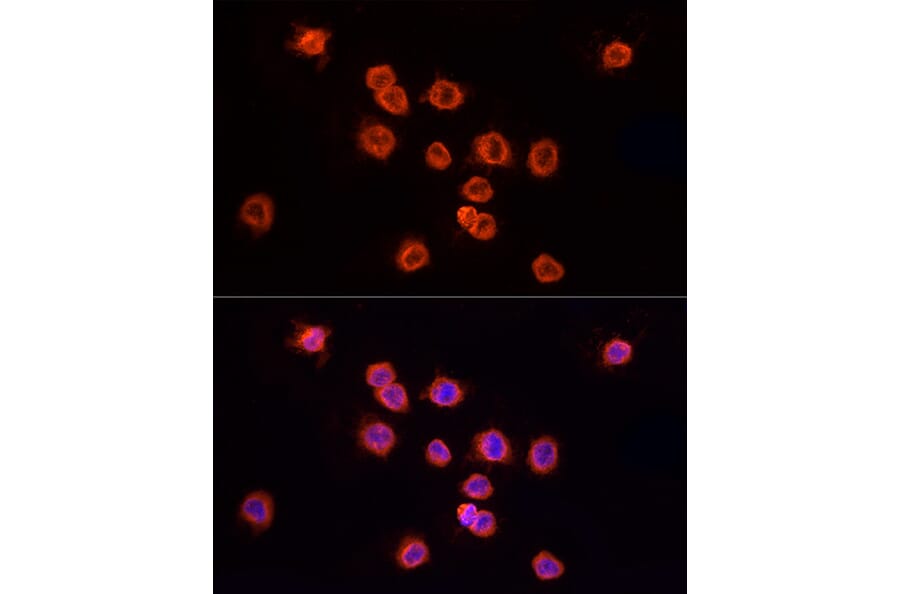 Immunofluorescence - Anti-YKL-40/CHI3L1 Antibody (A89883) - Antibodies.com