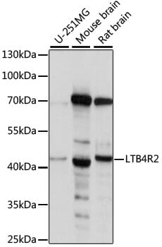 Western blot analysis of extracts of various cell lines, using Anti-LTB4R2 Antibody (A15479).
Secondary antibody: Goat Anti-Rabbit IgG (H+L) (HRP) (AS014) at 1:10,000 dilution.
Lysates / proteins: 25µg per lane.
Blocking buffer: 3% non-fat dry milk in TBST.
Detection: ECL Basic Kit (RM00020).
Exposure time: 10s.