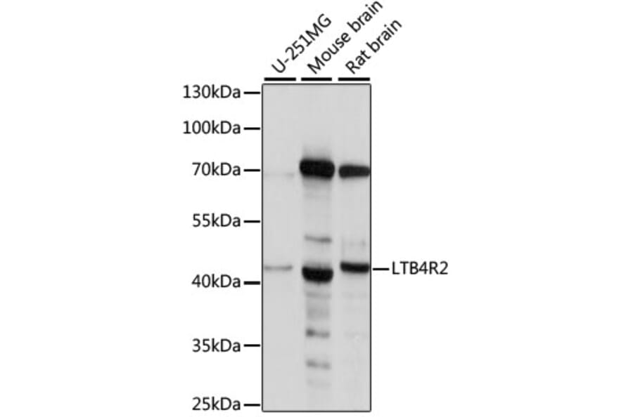 Western Blot - Anti-Leukotriene B4 Receptor 2 Antibody (A89884) - Antibodies.com