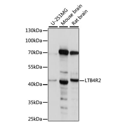 Western Blot - Anti-Leukotriene B4 Receptor 2 Antibody (A89884) - Antibodies.com