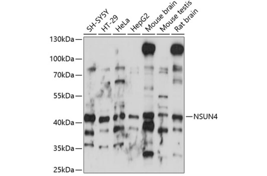 Western Blot - Anti-NSUN4 Antibody (A89885) - Antibodies.com