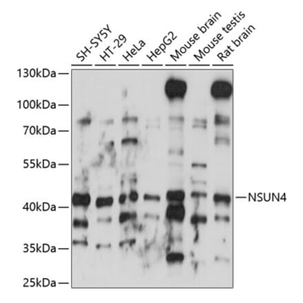 Western Blot - Anti-NSUN4 Antibody (A89885) - Antibodies.com