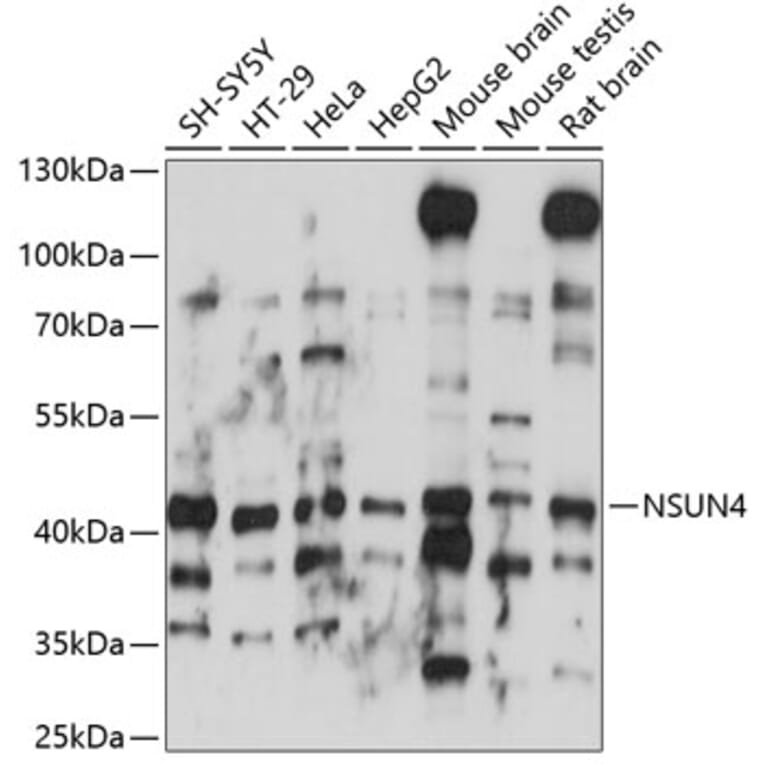 Western Blot - Anti-NSUN4 Antibody (A89885) - Antibodies.com