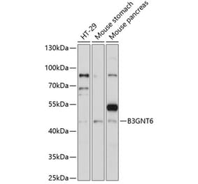 Western Blot - Anti-B3GNT6 Antibody (A89886) - Antibodies.com