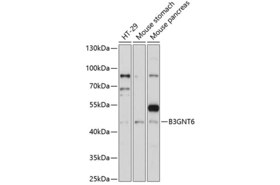 Western Blot - Anti-B3GNT6 Antibody (A89886) - Antibodies.com