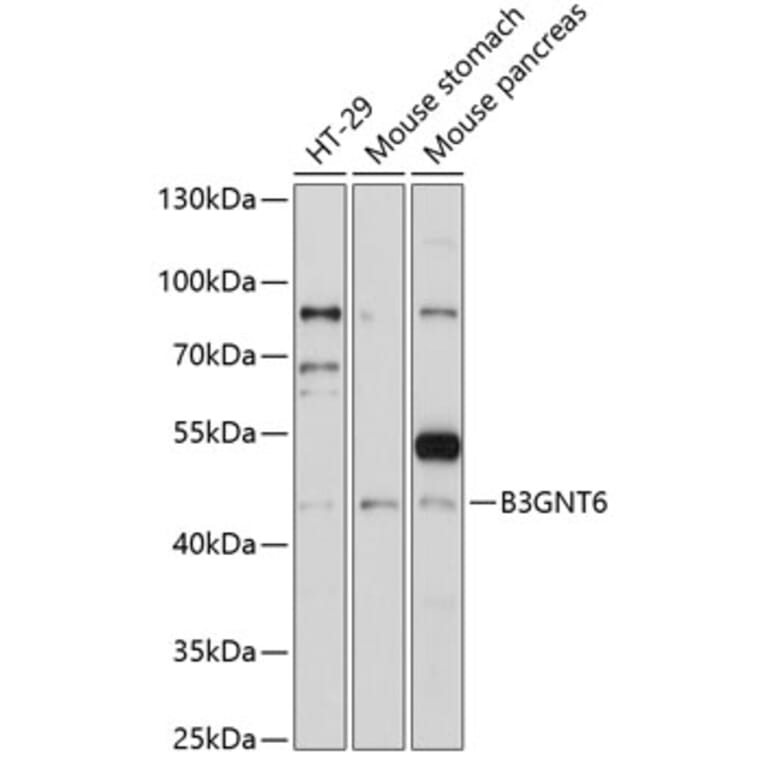 Western Blot - Anti-B3GNT6 Antibody (A89886) - Antibodies.com