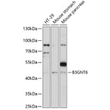 Western Blot - Anti-B3GNT6 Antibody (A89886) - Antibodies.com