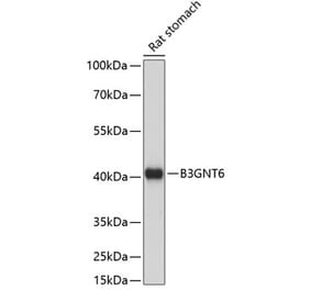 Western Blot - Anti-B3GNT6 Antibody (A89887) - Antibodies.com