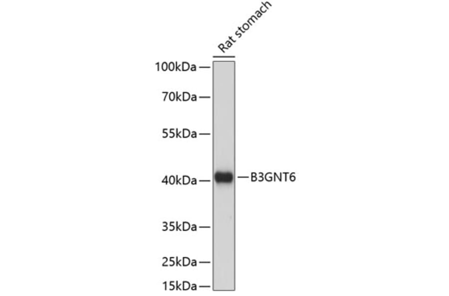 Western Blot - Anti-B3GNT6 Antibody (A89887) - Antibodies.com