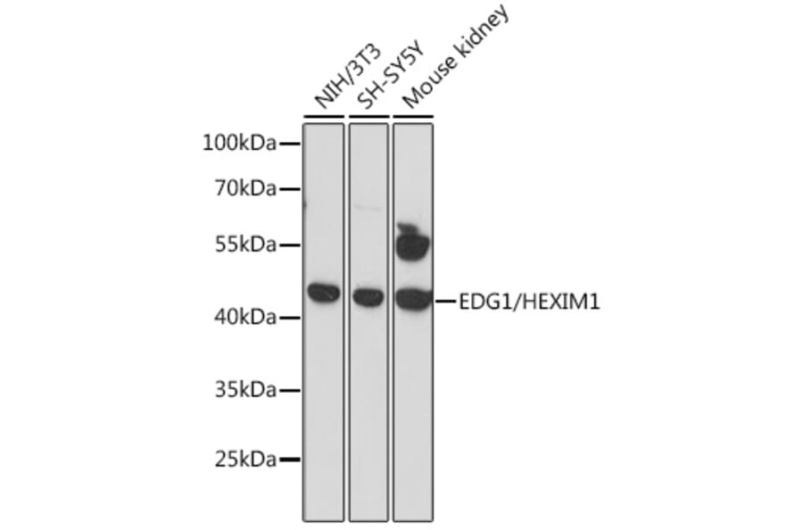 Western Blot - Anti-S1P1/EDG1 Antibody (A89888) - Antibodies.com