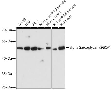 Western blot analysis of extracts of various cell lines, using Anti-SGCA Antibody (A4109) at 1:3000 dilution.
Secondary antibody: Goat Anti-Rabbit IgG (H+L) (HRP) (AS014) at 1:10,000 dilution.
Lysates / proteins: 25µg per lane.
Blocking buffer: 3% non-fat dry milk in TBST.
Detection: ECL Basic Kit (RM00020).
Exposure time: 90s.