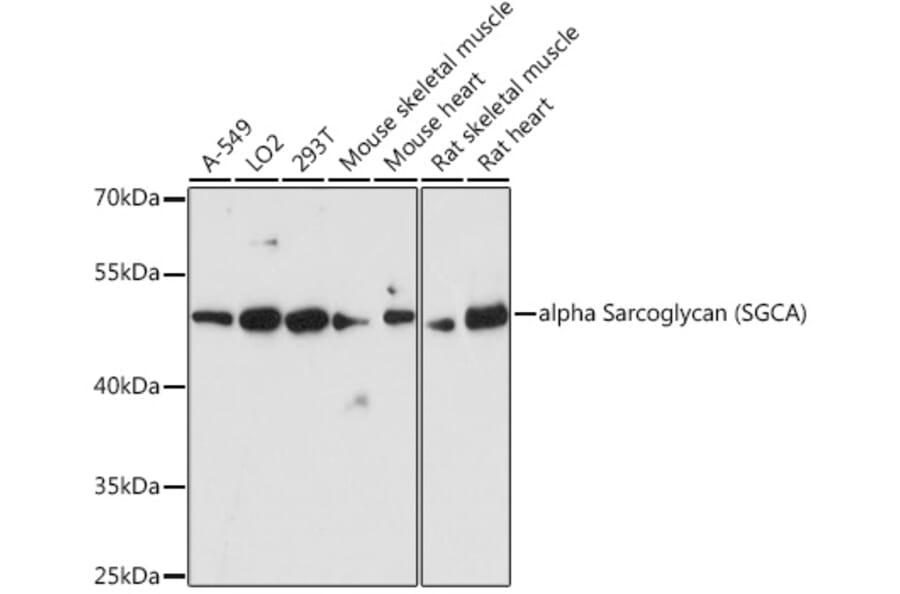 Western Blot - Anti-alpha Sarcoglycan Antibody (A89891) - Antibodies.com