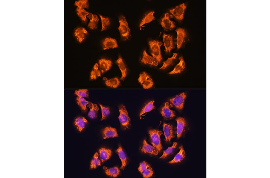 Immunofluorescence - Anti-alpha Sarcoglycan Antibody (A89891) - Antibodies.com
