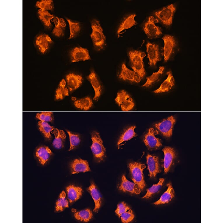 Immunofluorescence - Anti-alpha Sarcoglycan Antibody (A89891) - Antibodies.com