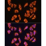 Immunofluorescence - Anti-alpha Sarcoglycan Antibody (A89891) - Antibodies.com