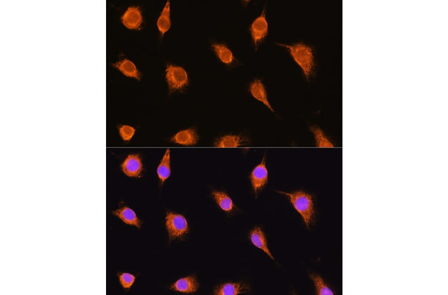 Immunofluorescence - Anti-alpha Sarcoglycan Antibody (A89891) - Antibodies.com