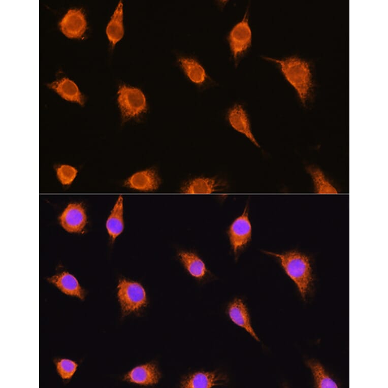 Immunofluorescence - Anti-alpha Sarcoglycan Antibody (A89891) - Antibodies.com