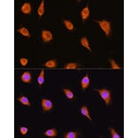 Immunofluorescence - Anti-alpha Sarcoglycan Antibody (A89891) - Antibodies.com