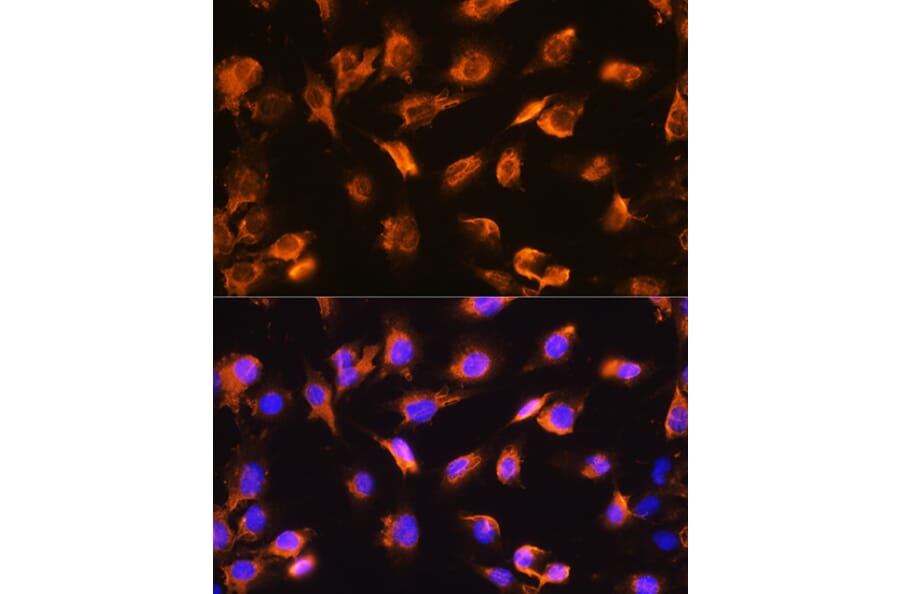 Immunofluorescence - Anti-alpha Sarcoglycan Antibody (A89891) - Antibodies.com