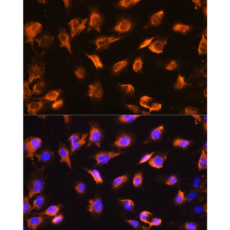 Immunofluorescence - Anti-alpha Sarcoglycan Antibody (A89891) - Antibodies.com