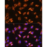 Immunofluorescence - Anti-alpha Sarcoglycan Antibody (A89891) - Antibodies.com