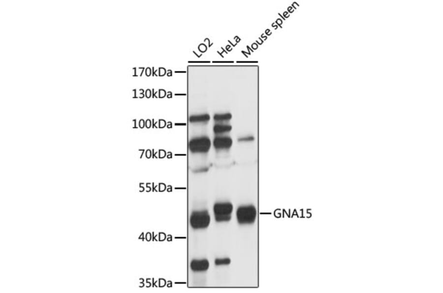 Western Blot - Anti-GNA15 Antibody (A89893) - Antibodies.com