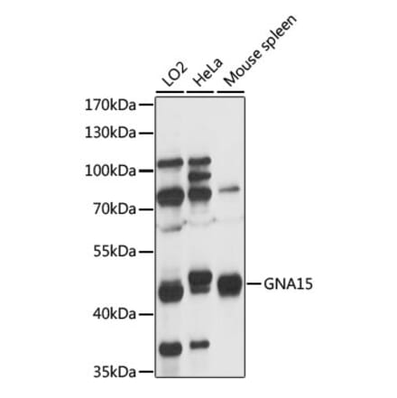 Western Blot - Anti-GNA15 Antibody (A89893) - Antibodies.com