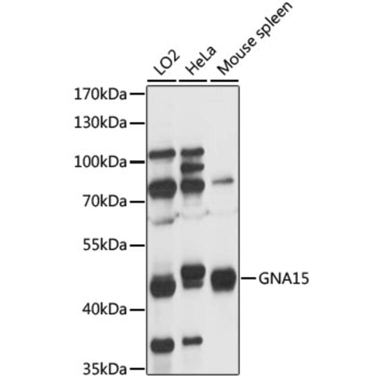Western Blot - Anti-GNA15 Antibody (A89893) - Antibodies.com