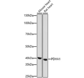 Western Blot - Anti-PDHA1 Antibody (A89894) - Antibodies.com