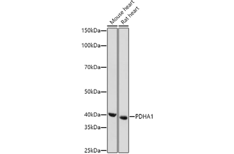 Western Blot - Anti-PDHA1 Antibody (A89894) - Antibodies.com