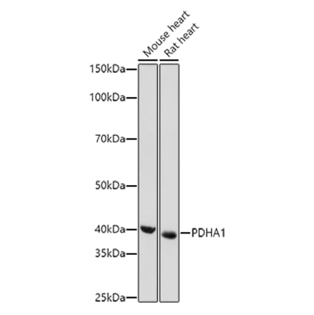 Western Blot - Anti-PDHA1 Antibody (A89894) - Antibodies.com
