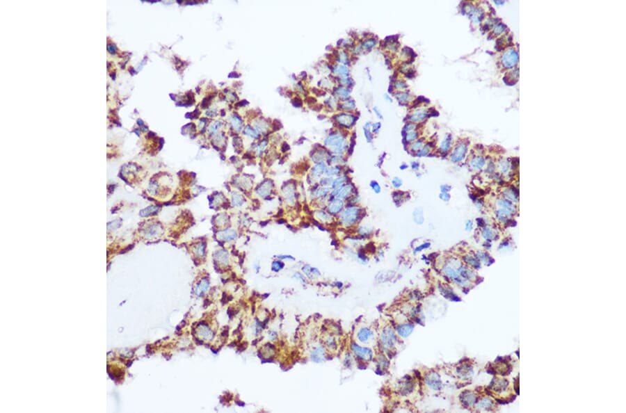 Immunohistochemistry - Anti-PDHA1 Antibody (A89894) - Antibodies.com